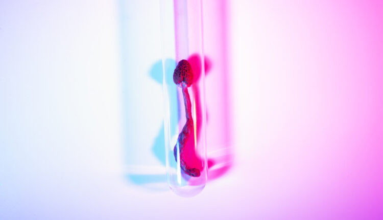 Psilocybin Yields Profound Mental Health Gains, According to New Study
